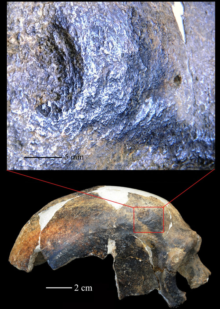 Lesions on the "maba man" skull fragments indicate someone (or something) got rough with him.