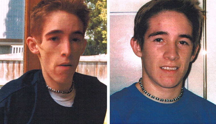 TJ Warschefsky is pictured here at the age of 21 before --  and after -- receiving three months of treatment at Rogers Memorial, a non-profit Psychiatric hospital in Wisconsin.  His mother, Susan Barry, said her son's perfectionism and desire for control may have made him more vulnerable to the disease that eventually took his life. Warschefsky died of anorexia in 2007 at the age of 22 after an eight-year battle. He was 78 pounds at the time.