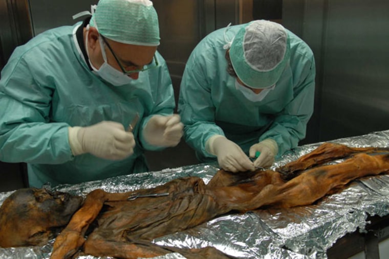 Dr. Eduard Egarter-Vigl, left, and Dr. Albert Zink take a sample from the Iceman in November 2010. The 5,300-year-old mummy dubbed Otzi was discovered in the Eastern Alps about 20 years ago. Tests show he was, among other things, lactose intolerant.