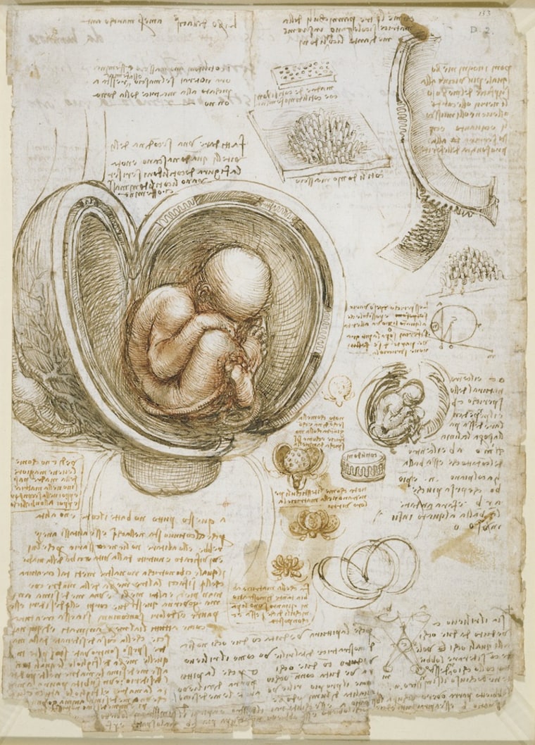 Leonardo da Vinci's sketches of a fetus in the womb, made between 1510 and 1513.