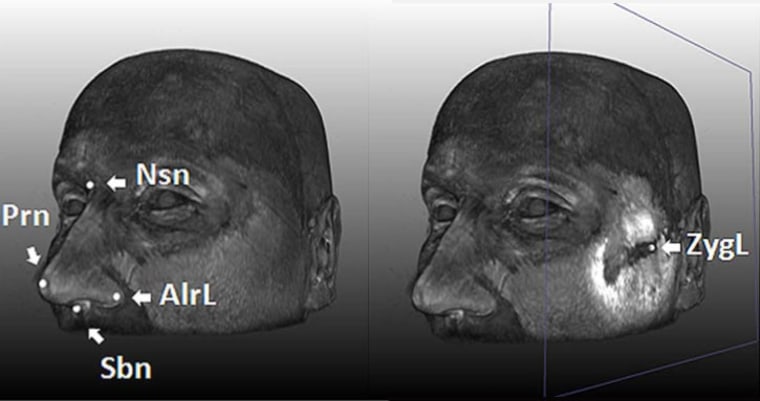 Scientists used 3-D MRI scans to look at various facial landmarks, confirming five genes that are responsible for various face-shape traits. They reported their findings online on Thursday in the journal PLoS Genetics.