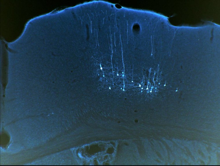 Image: Male mice motor cortext neurons