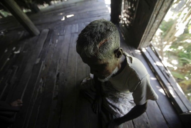 Image: Muhammad Amin, a Muslim man who was beaten with a metal pipe until his skull cracked, sits in his home in Paik Thay