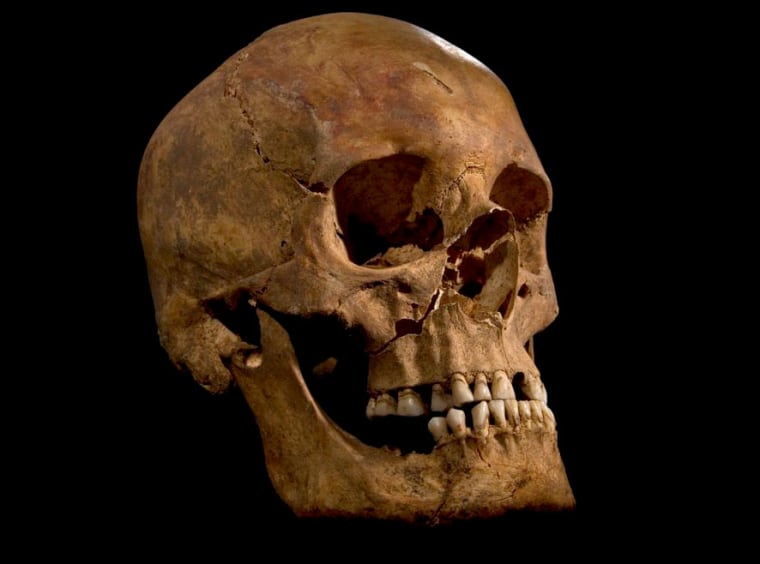 The skull of the skeleton found at the Grey Friars excavation in Leicester, potentially that of King Richard III.