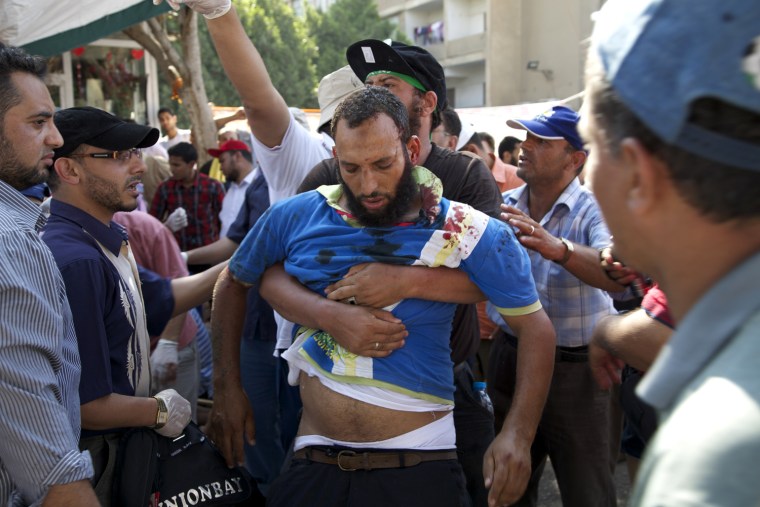 A man is helped by another demonstrator to the field medical center set up by Muslim Brotherhood volunteers. He was wounded during clashes by the Republican guards barracks - where Morsi is allegedly held -. some demonstrators told me they were heading there to "to break him free."