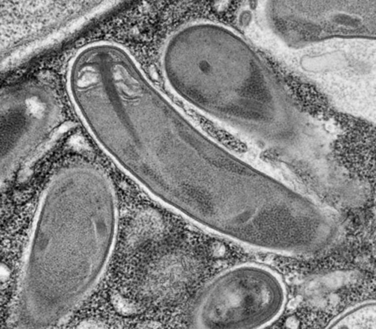 A new species of the tiny parasite was found in roundworms living in Parisian compost. Its spore – the stage that infects a host cell – is show above. 