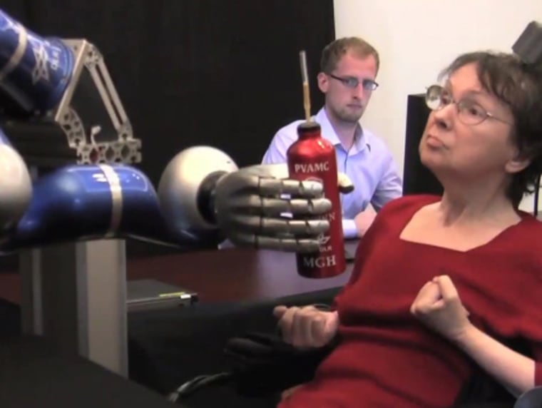 Paralyzed woman gets robotic arm she controls with her mind