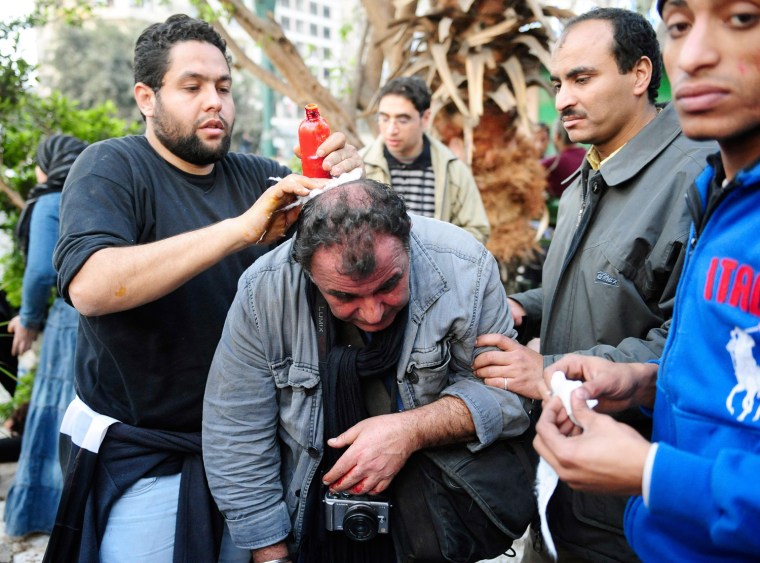 Image: French photojournalist Alfred Yaghobzadeh, wounded during clashes in Cairo