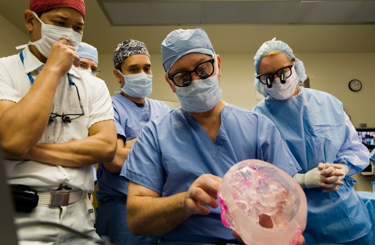In this undated photo from the Cleveland Clinic, the transplant team looks at a model of the patient's face during  the first face transplant surgery in the U.S. on patient Connie Culp. The 46-year-old mother of two lost most of the midsection of her face to a gunshot in 2004. The initial surgery by the Cleveland Clinic team took place in December 2008. Left to right are, Drs. Risal  Djohan, Daniel Alam, Frank Popay,foreground, and head surgeon Dr. Maria Siemionow   (AP Photo/Cleveland Clinic-HO)