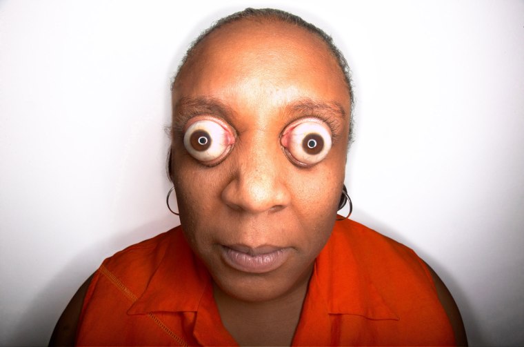 Farthest eyeball pop
Kim Goodman of the U.S. can pop her eyeballs to a protrusion of 11 millimeters (0.43 inch) beyond her eye sockets. Her eyes were measured on the set of the television show \"Guinness World Records: Primetime,\" in Los Angeles, Calif., on June 13, 1998.