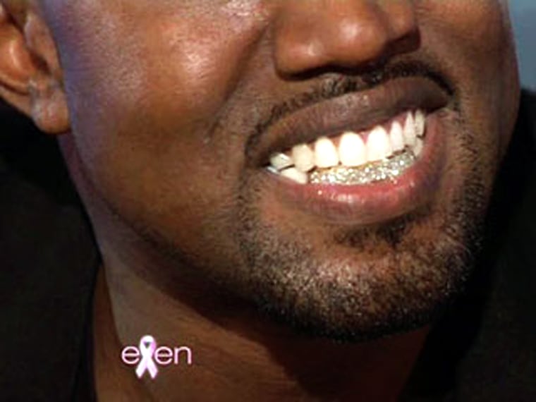 Image: Kanye West's diamond teeth