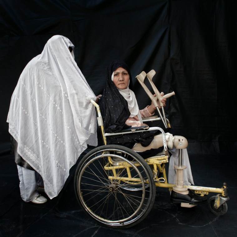 Image: Afghan Land Mine Victims Pose For Portraits