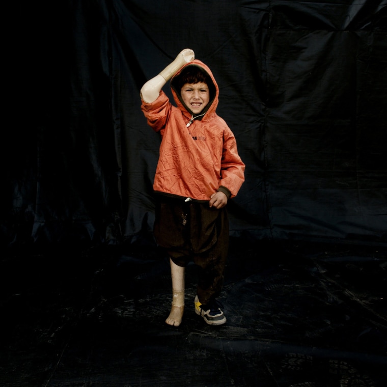 Image: Afghan Land Mine Victims Pose For Portraits