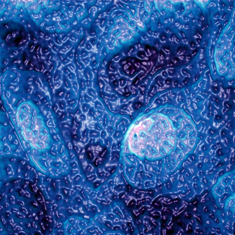 Photography Ð First Place
Rough Waters
This blue nanoscale landscape is created by two types of molecules on a gold surface that form a
self-assembled monolayer thereby enabling control of the surface properties. At this extreme limit
of turnability it becomes possible to adjust the character of surfaces, opening up possibilities in
self-cleaning materials and beyond.
[Image courtesy of Seth B. Darling Ð Argonne National Laboratory; Steven J. Sibener Ð
University of Chicago]