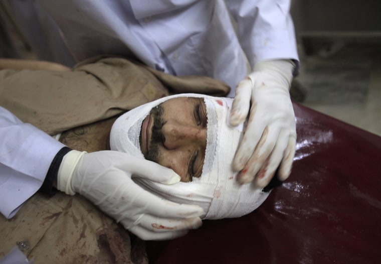 Image: A man, injured by a suicide bomb blast in Dir, is treated after being brought to the Lady Reading Hospital in Peshawar northwest Pakistan