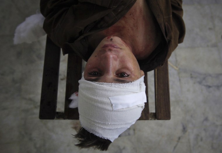 Image: A tear runs down a boy's face as he lies on a bench after being treated for his injuries at the Lady Reading Hospital in Peshawar