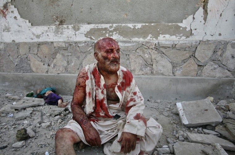 Image: Mohammad Azam, 56, sits injured in front of a dead child, at the site of a double suicide bombing in Quetta