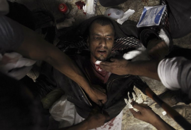 Image: A protester wounded during clashes with Egyptian riot police is treated at a field hospital near Tahrir Square