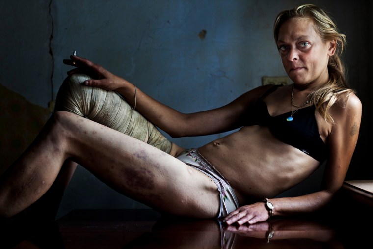 Image: Stirton of South Africa has won first prize Contemporary Issues Singles with this picture of Maria, a drug addict and sex worker, in Kryvyi Rig
