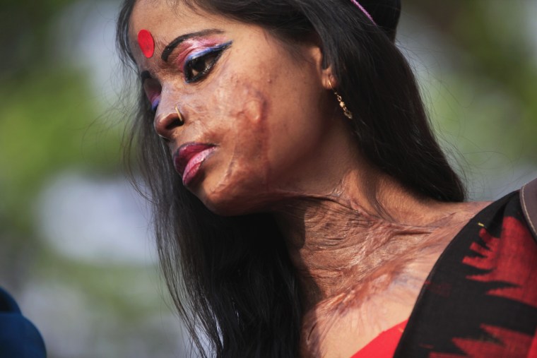 Image: Hasina, a survivor of an acid attack, takes part in an awareness rally about the violence against women as they mark International Women's Day in Dhaka