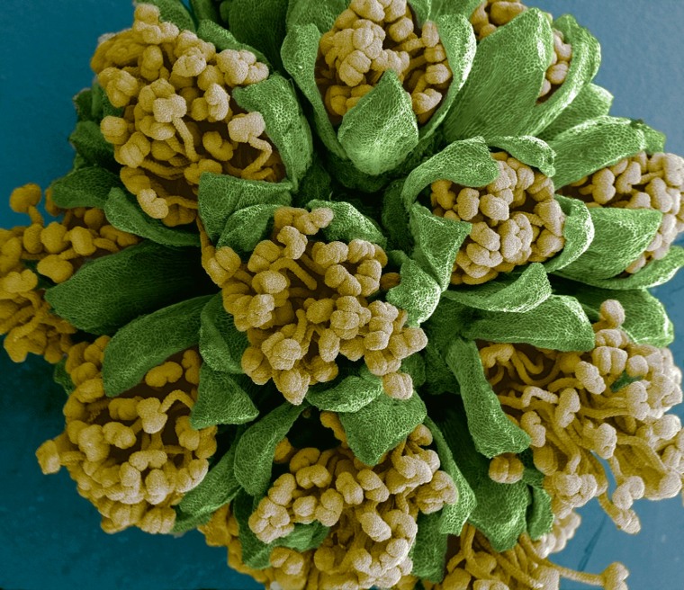 In this SEM image we can see an Acacia dealbata (yellow mimosa) flower about to open. The HFW is 4.35 mm. The image was taken with the flower in a fresh state, extracted from the tree and put onto the microscope at the moment. Also the image was taken as soon as possible to avoid high structure damage. False color applied by Photoshop.

&lt;i&gt;Courtesy of Marcos Rosado&lt;/i&gt;

&lt;u&gt;Image Details&lt;/u&gt;
&lt;b&gt;Instrument used:&lt;/b&gt; Quanta Family
&lt;b&gt;Magnification:&lt;/b&gt;  69x
&lt;b&gt;Horizontal Field Width:&lt;/b&gt;  4.35 mm
&lt;b&gt;Vacuum:&lt;/b&gt;  High Vacuum
&lt;b&gt;Voltage:&lt;/b&gt;  1.5 kV
&lt;b&gt;Spot:&lt;/b&gt;  3.0
&lt;b&gt;Working Distance:&lt;/b&gt;  15mm
&lt;b&gt;Detector:&lt;/b&gt;  SE