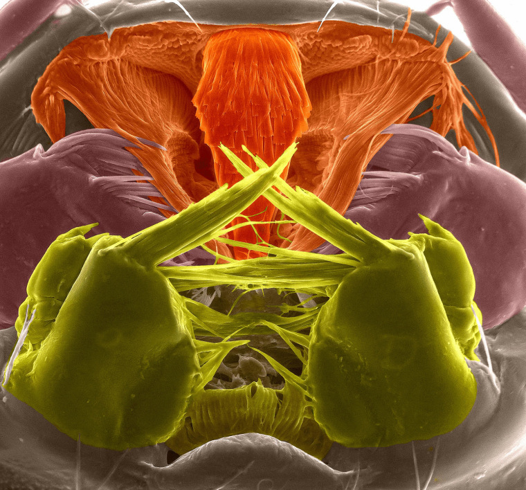 Mouthparts filter of an aquatic larva of third age of Asian Tiger mosquito (Aedes albopictus).