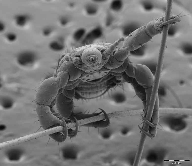 Lice olympics (pole vault). Head lice on two human hair.

&lt;i&gt;Courtesy of Louwrens Tiedt&lt;/i&gt;