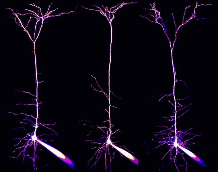 Dr. Alexandre William Moreau
Institute of Neurology, University College London
London, UK
Pyramidal neurons and their dendrites visualized in the visual cortex of a mouse brain
2-Photon, Focus Stacking, Fluorescence, Patch clamp
40X