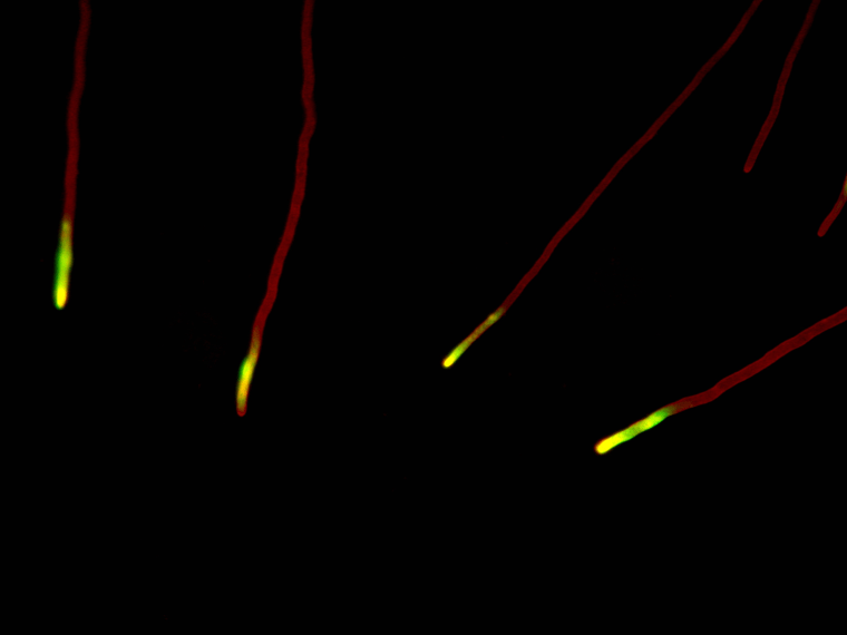 Dr. Christian Q. Scheckhuber
Goethe University
Frankfurt, Germany
Podospora anserina (fungus) filamentous tip cells
Fluorescence
630X