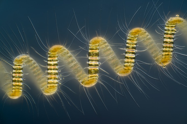 Mr. Wim van Egmond
Micropolitan Museum
Berkel en Rodenrijs, Zuid Holland, The Netherlands
Chaetoceros debilis (marine diatom), a colonial plankton organism
Differential Interference Contrast, Image Stacking
250X