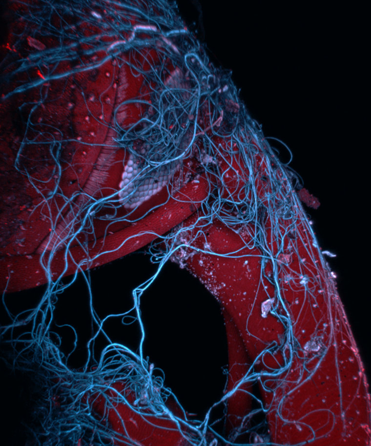 Mr. Mark A. Sanders
University Imaging Centers, University of Minnesota
Minneapolis, Minnesota, USA
Insect wrapped in spider web
Confocal, Autofluorescence, Image Stacking
85X