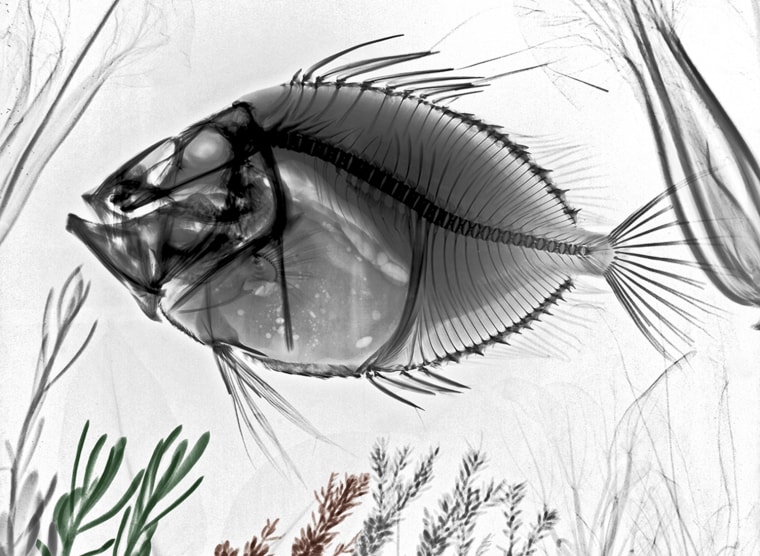 John Dory fish, X-ray