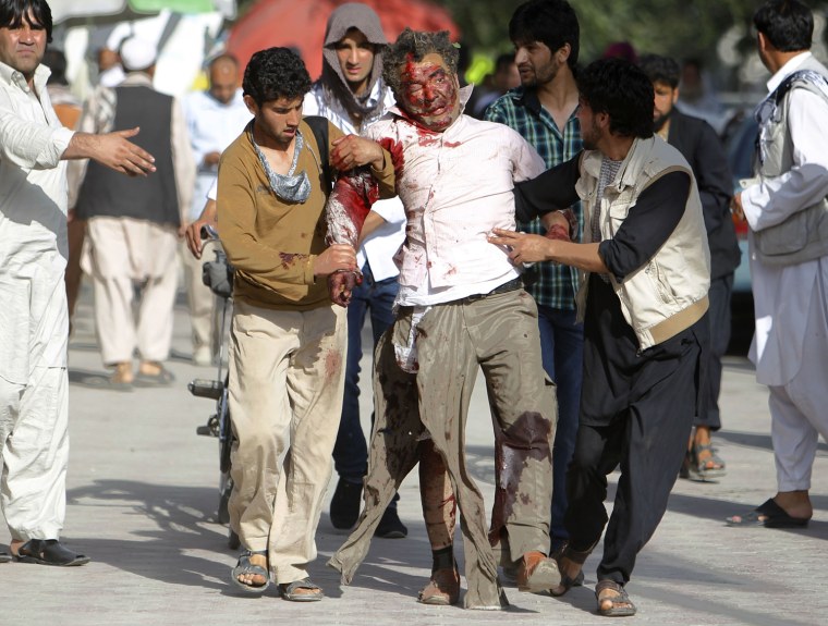 Image: Men carry another man who was wounded during a suicide car bomb attack in Kabul