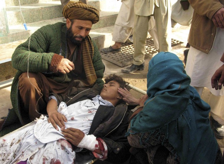 Image: A mother touches her wounded son after a suicide attack in Emam Saheb district of Kunduz province