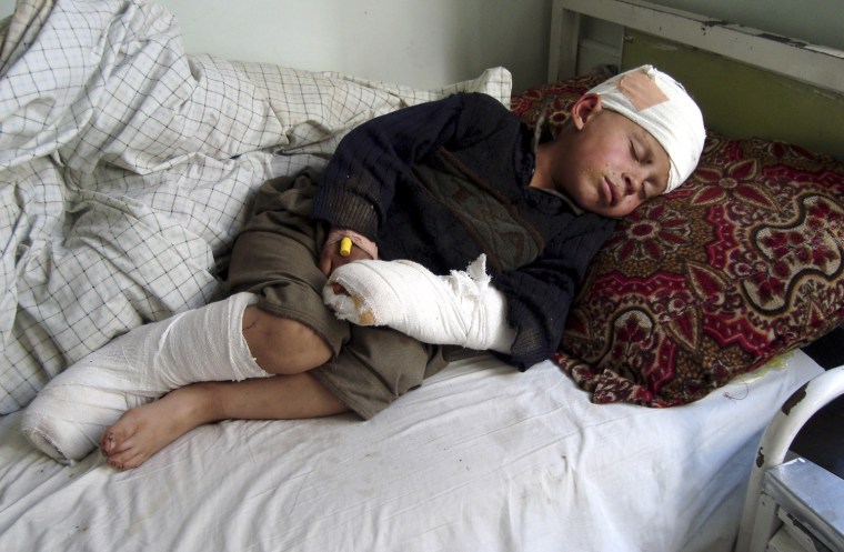 Image: A boy, injured during a NATO air strike, lies on a hospital bed in Afghanistan's eastern Kunar province