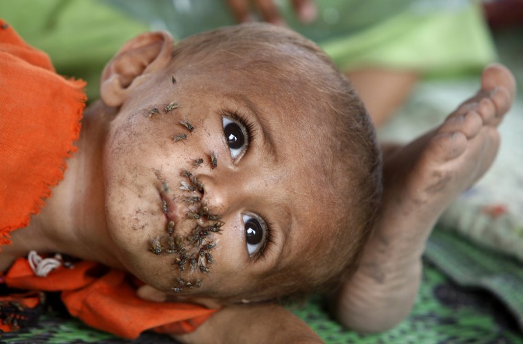 Image: Flies sit on the face of one-year-old Zameera while she takes refuge with her family in a relief camp for flood victims in Sukkur