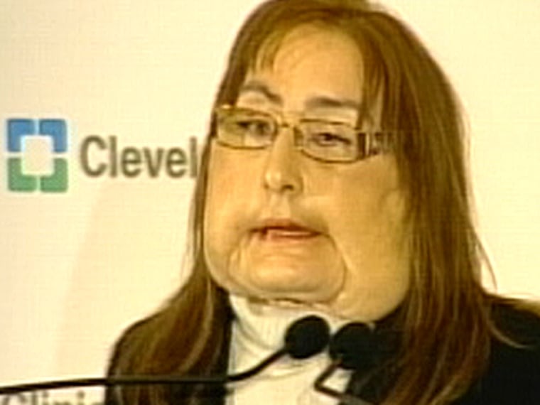 Connie Culp speaking at a press conference after her operation in 2009.