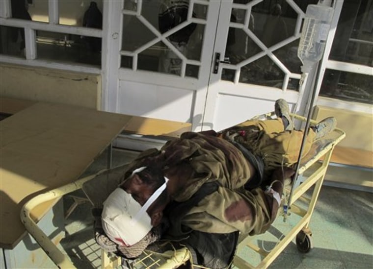 An Afghan man wounded in an explosion lies on a stretcher at a local hospital in Kunduz, Afghanistan, Saturday, Nov. 13, 2010. (AP Photo/Foulad Hamdard)