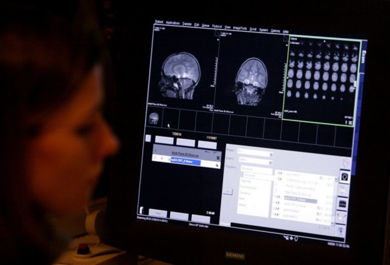 President Obama hopes a new research initiative will lead to cures for various brain diseases and economic growth. (AP)