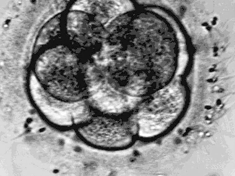An eight-cell embryo is shown three days after insemination in this undated Eastern Virginia Medical School handout.