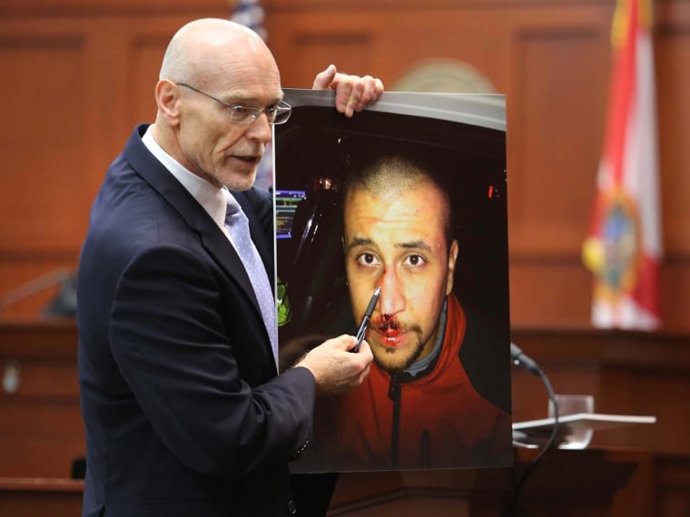 Don West, a defense attorney for George Zimmerman, displays a photo of his client from the night of the shooting during opening statements in Zimmerman’s trial. (AP Photo/Orlando Sentinel, Joe Burbank, Pool)