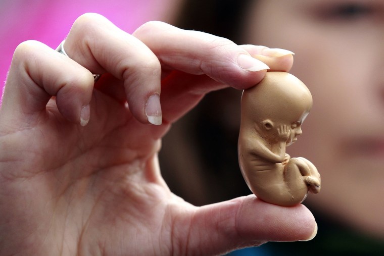 A pro-life campaigner holds up a model of a 12-week-old embryo during a protest outside a clinic on Oct. 18, 2012. (Photo by Cathal McNaughton/Reuters)