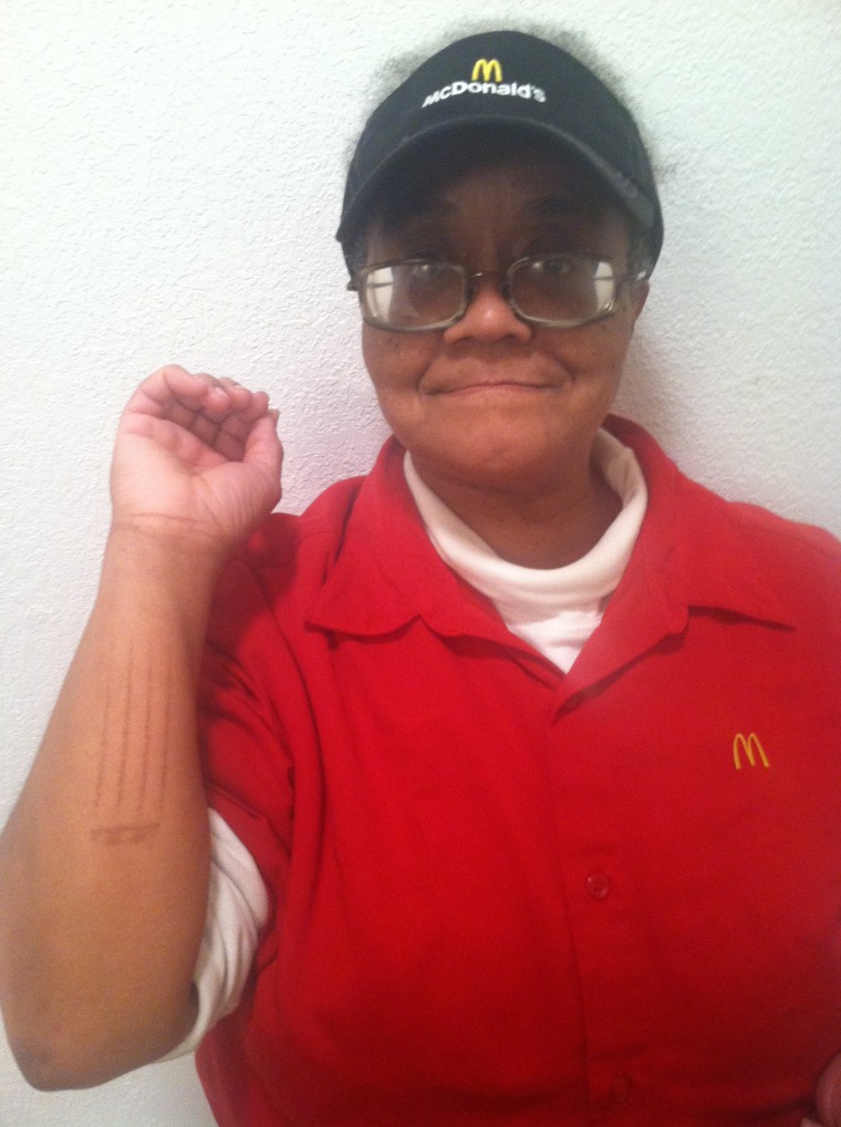 Verneshia Cook, 56, seen in a photo provided by her, has worked at McDonalds in Kansas City, Mo., since 2003. Under pressure from her boss to work too fast, Cook burned her forearm on hot grease while pulling fries out of the fryer.