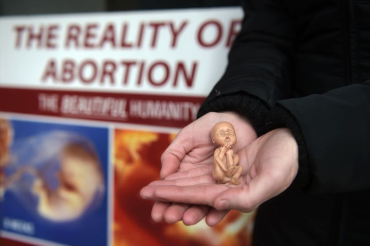 A Pro Life campaigner displays a plastic doll representing a 12 week old foetus as she stands outside the Marie Stopes Clinic on April 7, 2016 in Belfast, Northern Ireland. (Photo by Charles McQuillan/Getty)
