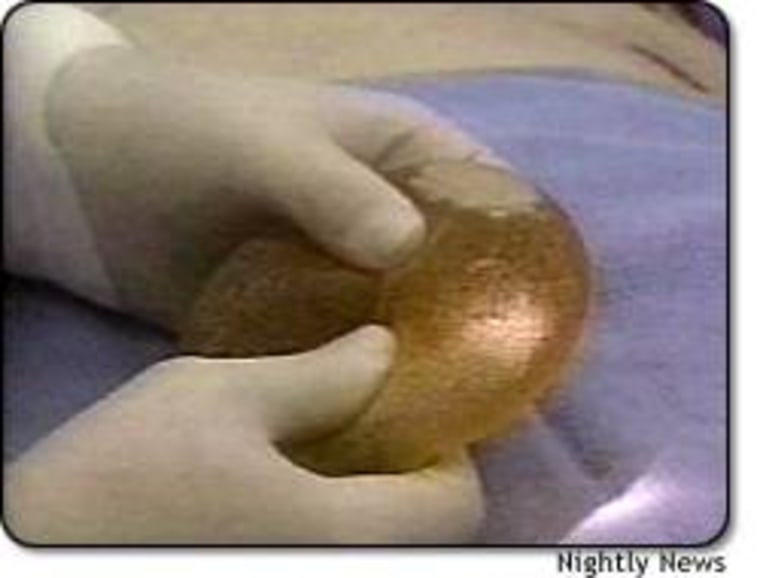 American women are closer to being able to choose silicone breast implants for cosmetic surgery. 