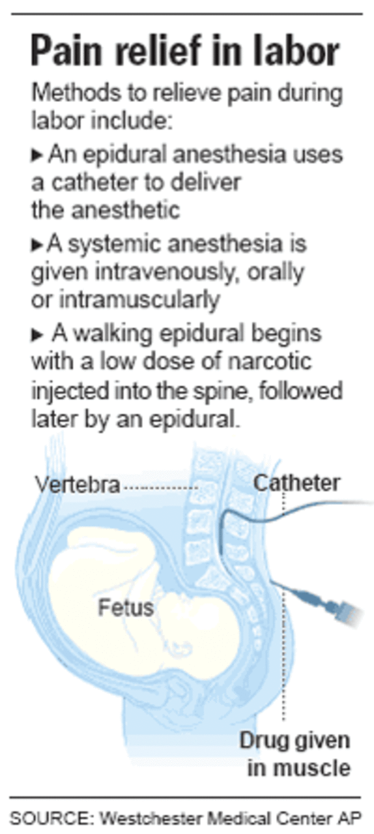 EPIDURAL