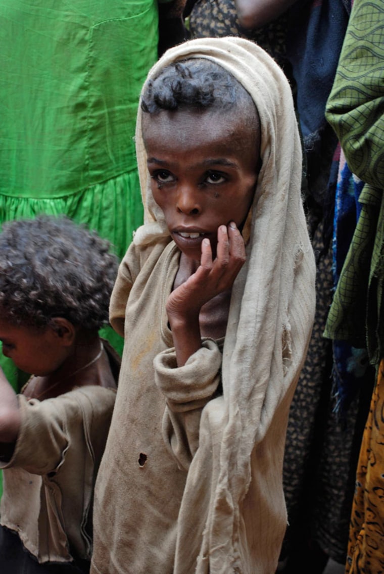 Image: Six year old malnourished Tariken Lakamu waits for food aid in Ethiopian