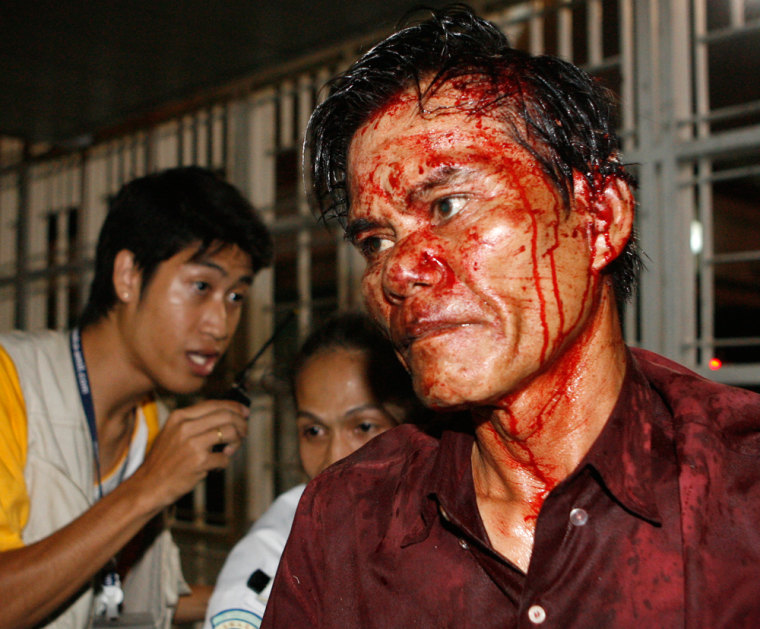 Image: An injured government supporter