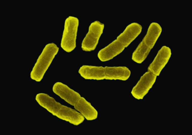 Getty Images |
 
The Workhorse
E. coli bacteria are shown. A San Diego-based company claims they will have a pilot plant for production of E. coli-based plastic by next year.