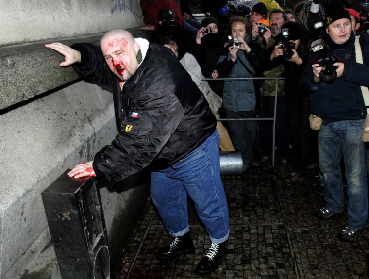 Image: Czech neo-nazi leans on the wall after he was injured during clashes with anti-fascist activists